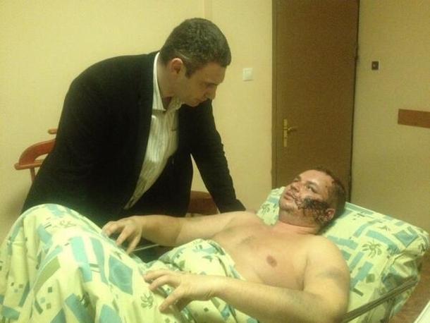 Меня распяли, лицо порезали, ухо отрезали, на теле живого места нет, - Булатов рассказал о зверствах похитителей. ВИДЕО