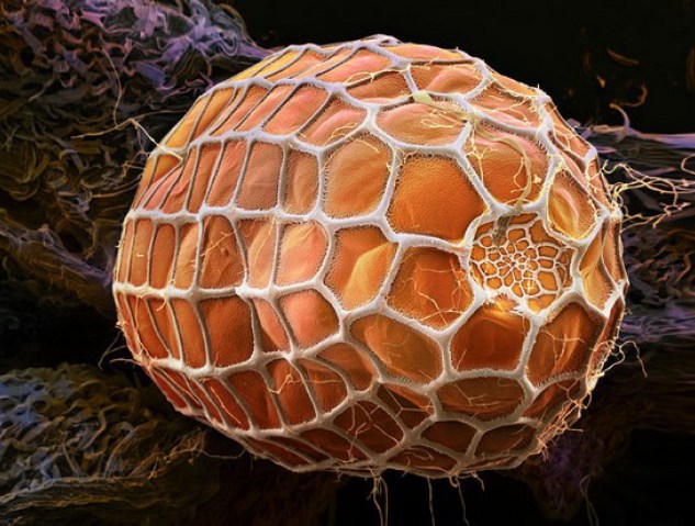 Яйцо длиннокрылой бабочки-зебры - 30+ Фотографий под Микроскопом