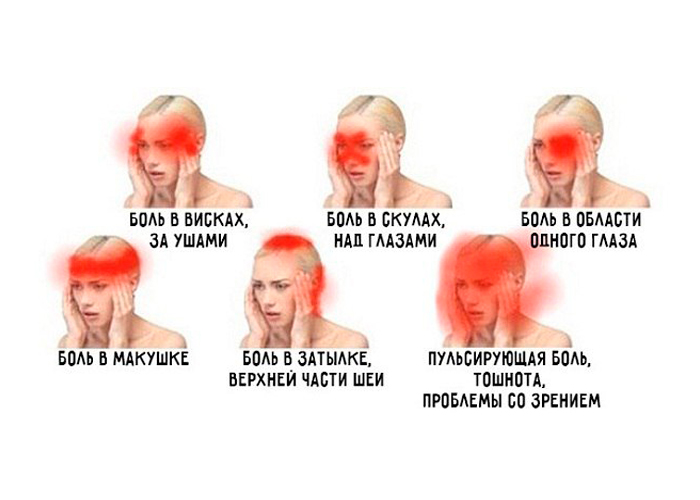О чем говорит боль в разных частях головы?